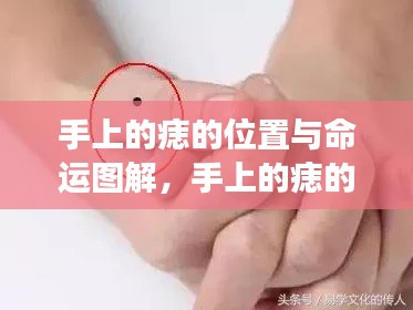 手上痣的位置与命运图解，揭示痣相深层含义的奥秘